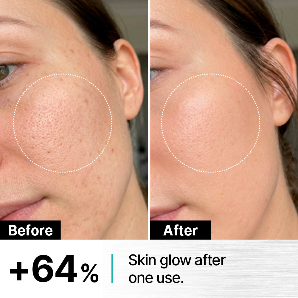 DUAL INFUSHOT™ SKINBOOSTER SERUM