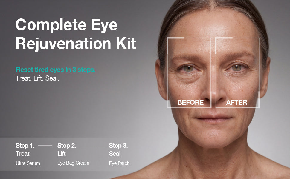 Complete Eye Rejuvenation Kit