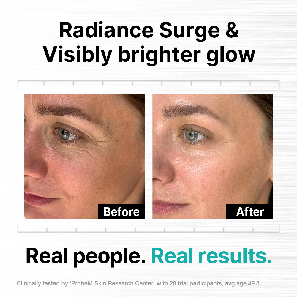 Needle-Free Skin Stimulation Serum