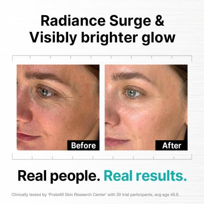 Needle-Free Skin Stimulation Serum