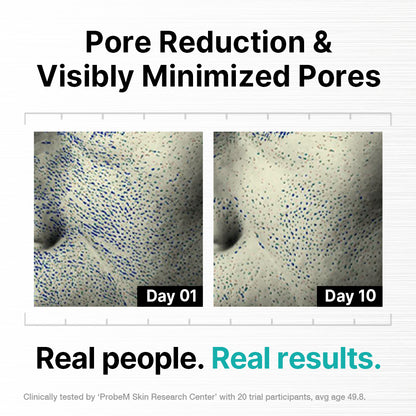 Needle-Free Skin Stimulation Serum