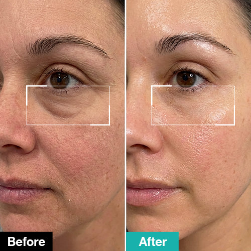 Liftcore™ Eye Gel Patch