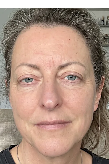 Before