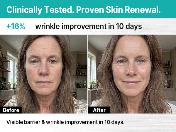 Ultra Serum before and after ten days, 16.1% eye-wrinkle depth improvement