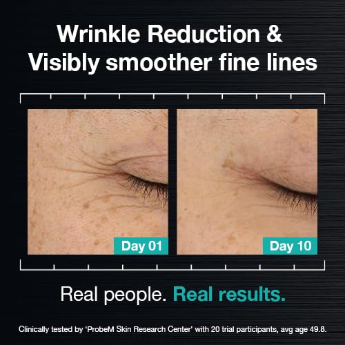 ULTRA WRINKLE CORREXION™  SERUM