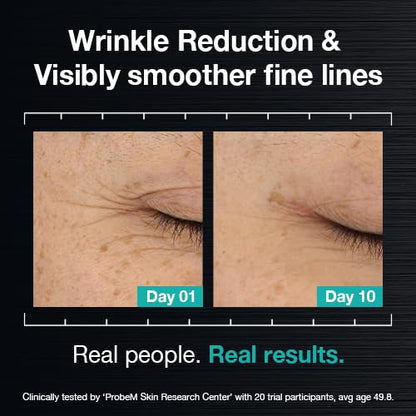 ULTRA WRINKLE CORREXION™  SERUM