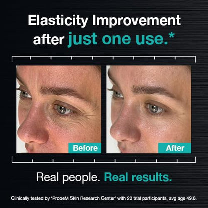 ULTRA WRINKLE CORREXION™  SERUM